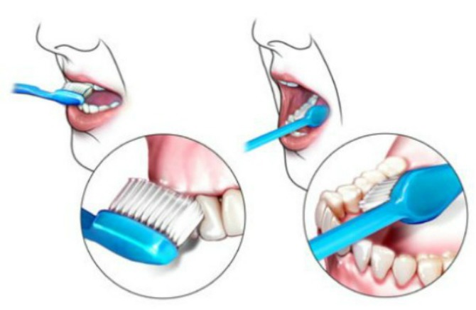 brushteeth11 Tehnike pranja zuba 