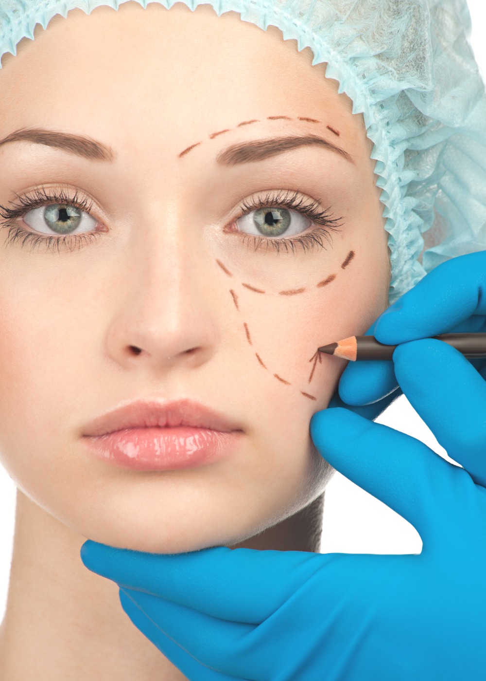 cosmetic surgery 61 Estetska hirurgija: Nezadovoljna svojim telom? Operiši se! 