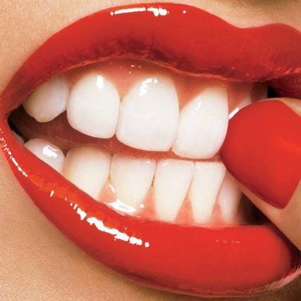 Sve što treba da znate o beljenju zuba