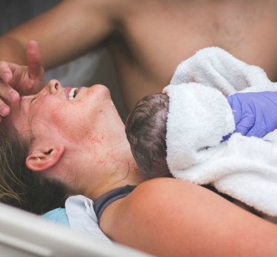 Dirljive fotografije koje svedoče o lepoti rađanja